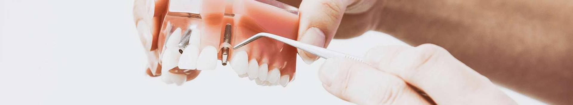 Hambaravi kliinik ConfiDental - kõrgelt kvalifitseeritud hambaravi abi osutamine. Meie hambakliinik on Haigekassa pikaajaline koostööpartner.