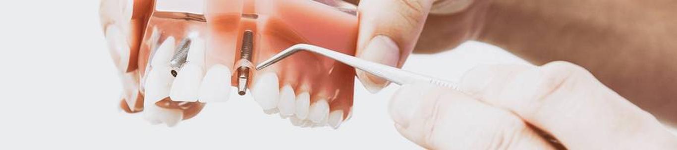 Densprax OÜ pakub laia spektriga hambaraviteenuseid: impantoloogiat, komplitseeritud proteesimist, igemehaiguste ravi, hammaste ravi ja suuhügienisti teenuseid. Densprax OÜ-l on leping Eesti Haigekassaga alla 19 aastaste ...
