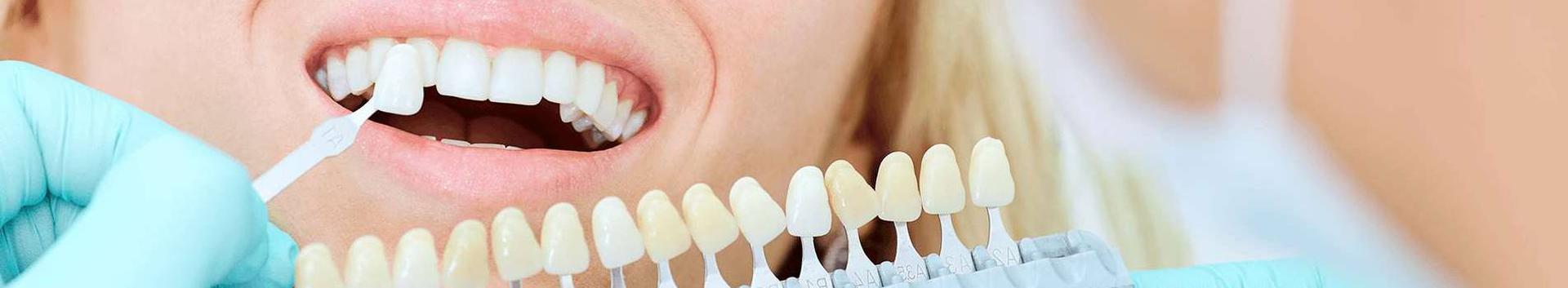 Patsiendikeskne hambaravi Ruta Ottesson Hambaravi visiooniks on pakkuda kaasaegset patsiendikeskset hambaraviteenust. Oleme loonud oma patsientidega usaldusliku suhte nende hammaste tervishoiuks. Arvestame raviplaani koostamisel patsientide soove ja võimalusi. Seetõttu on meie patsientide rahulolu osutatud teenusega väga hea. Meie hambaarstid kuuluvad ka mõlemad Eesti Hambaarstide Liitu, mis annab võimaluse olla kursis hambaravis toimuvaga ja on abistavaks enda […]