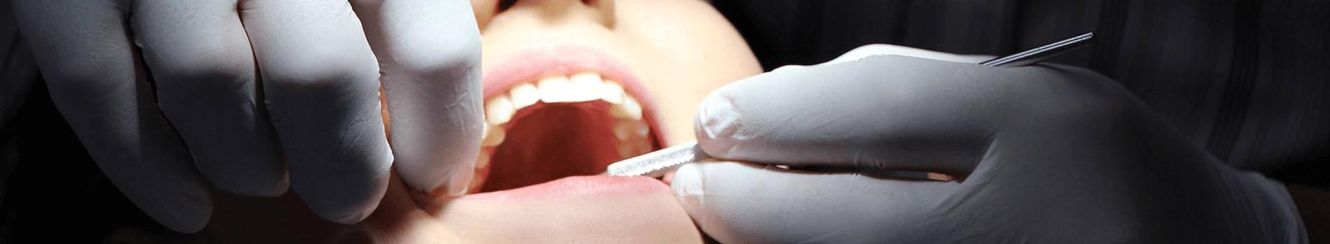 Hambaarst, hambakirurgia, Hambaproteesimine