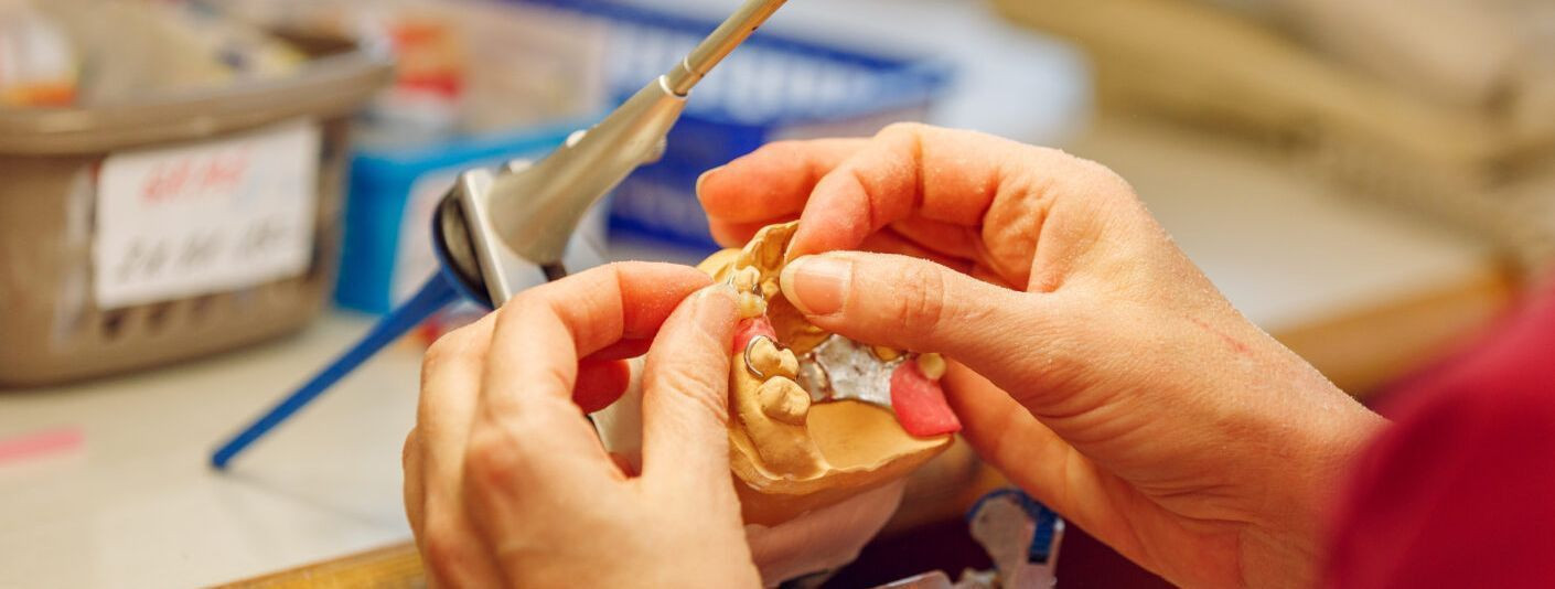 Maintaining dentures is crucial for both the longevity of the prosthetics and the health of your mouth. Proper care ensures that your dentures stay clean, comfo