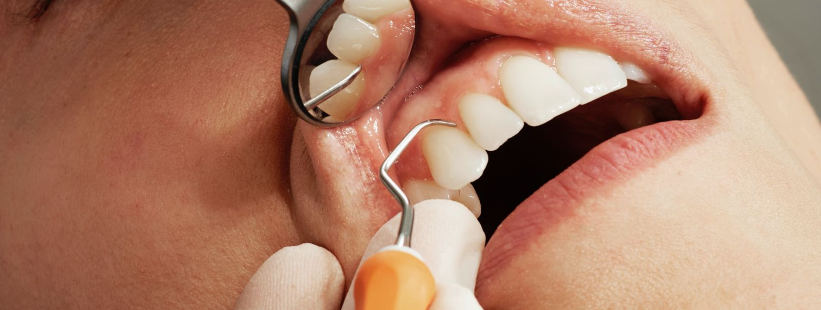 Kui otsite usaldusväärset ja professionaalset hambaraviteenust, siis olete jõudnud õigesse kohta. EPP SARAPUU HAMBARAVI on kogemustega hambaravikliinik, kus pak