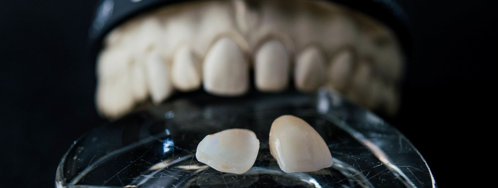 Hammaste proteesid on kunstlikud seadmed, mis on mõeldud puuduvate hammaste asendamiseks, suu funktsioonide taastamiseks ja esteetilise välimuse parandamiseks. 