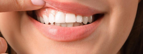 Kuidas saab esteetiline hambaravi aidata tõsta enesekindlust?