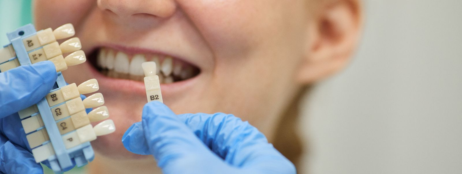 Hambaimplantaadid on kaasaegne lahendus puuduvate hammaste asendamiseks. ...