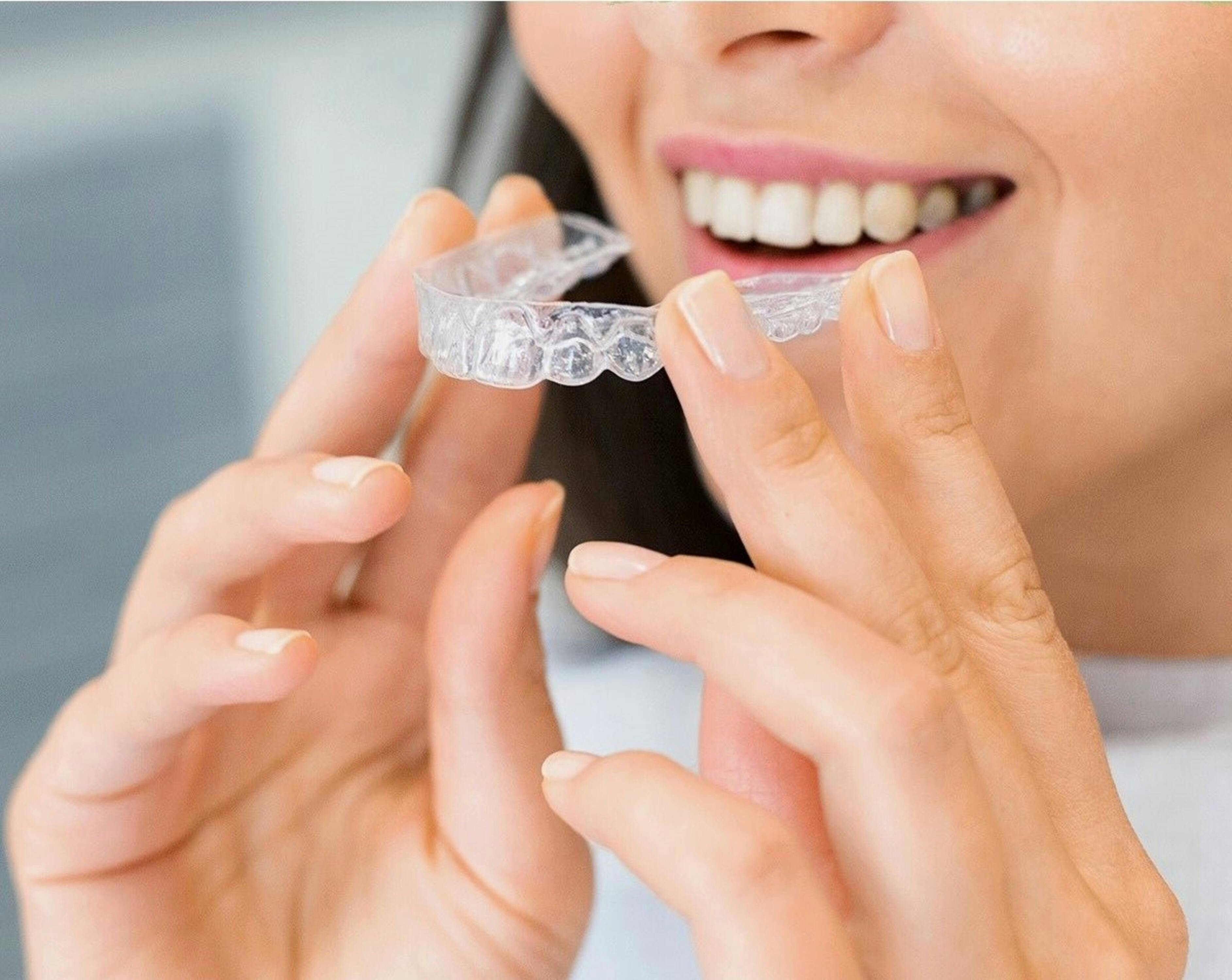 The modern solution for teeth straightening    Aligner-ravi   is a modern and aesthetic way to straighten teeth, which helps to improve the look of a smile with